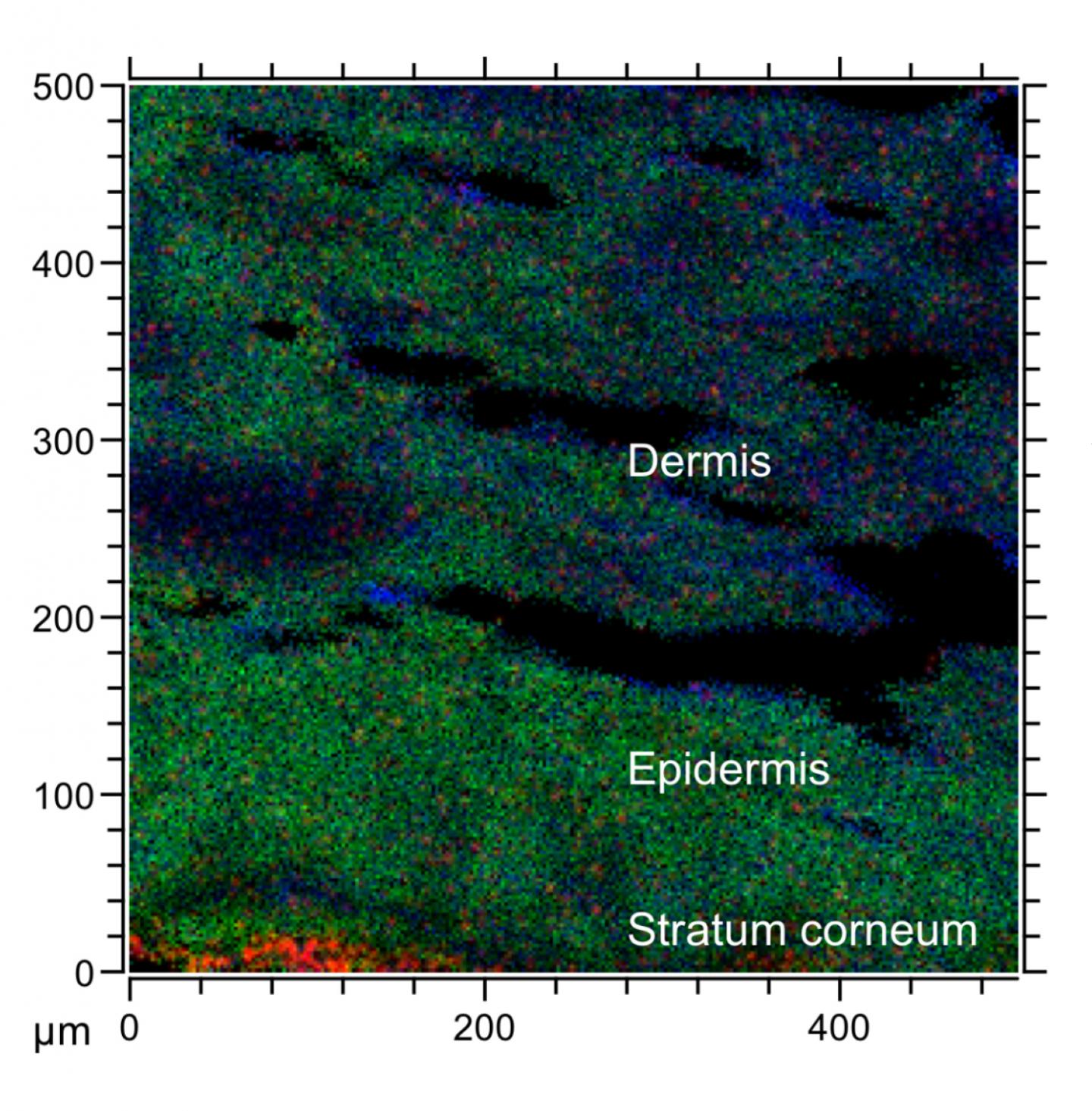 3D-imaging