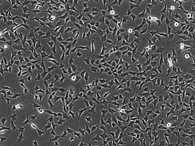 mesenchymal arterial cells