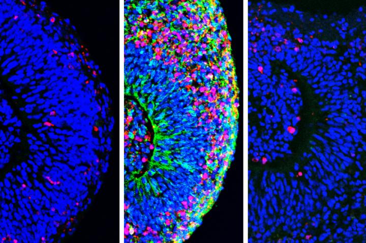 organoids