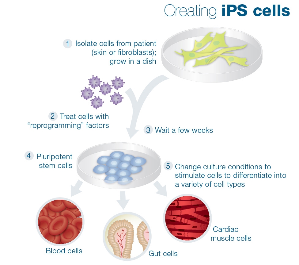 Using Skin Cells to Model Diabetes in Humans